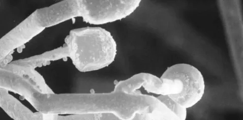 Imagem ilustrativa da imagem EUA registram pela 1ª vez casos de supermicose contagiosa