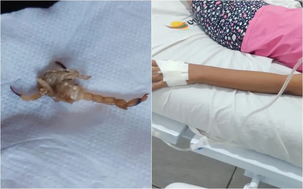 Imagem ilustrativa da imagem Criança é atacada por escorpião ao calçar bota em Catalão