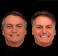 Imagem ilustrativa da imagem Jair Bolsonaro faz harmonização facial com dentes de R$3 mil