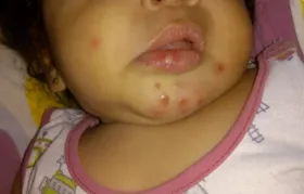 Imagem ilustrativa da imagem Laudo indica infecção generalizada em bebê que morreu após tomar injeção com dipirona