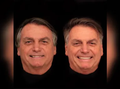 Imagem ilustrativa da imagem Jair Bolsonaro faz harmonização facial com dentes de R$3 mil