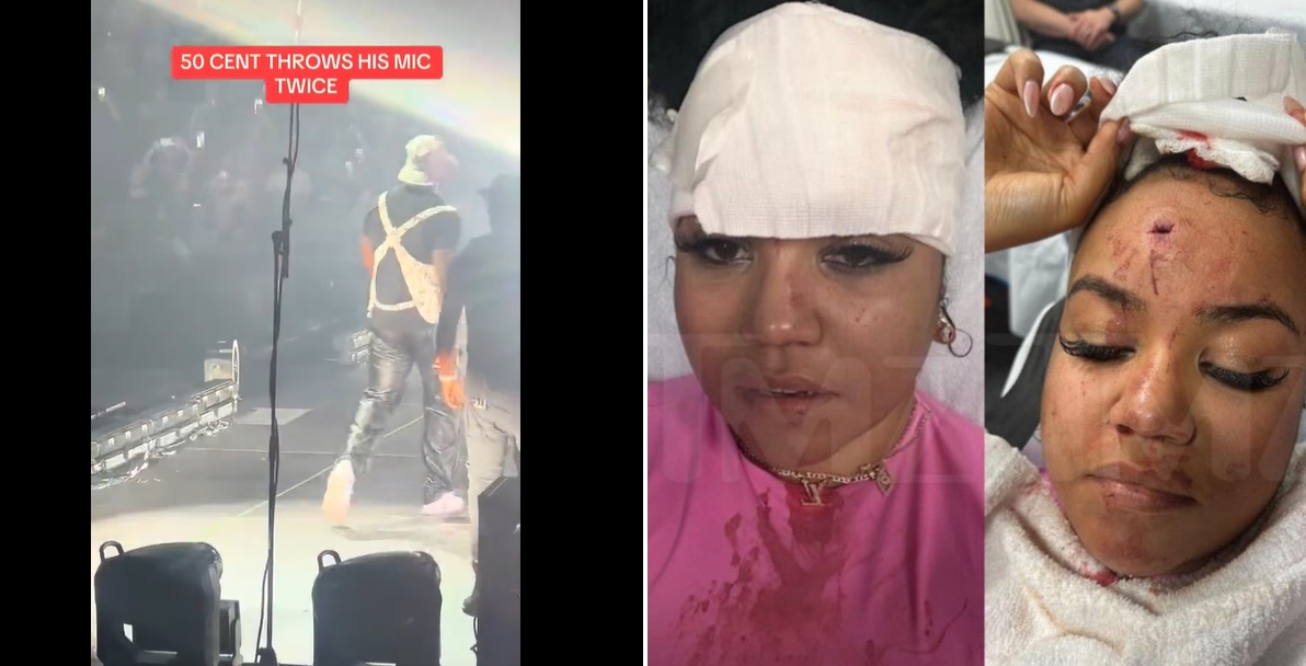 Rapper 50 Cent hurts a fan during a concert in Los Angeles