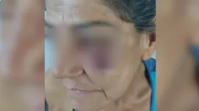 Imagem ilustrativa da imagem Mãe fica ferida após tentar impedir que a nora fosse agredida