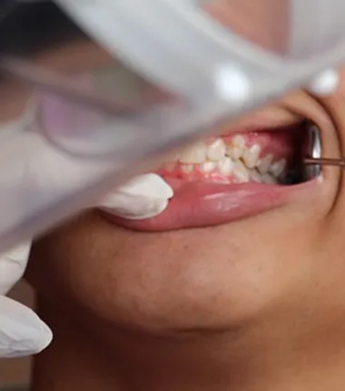 Imagem ilustrativa da imagem A crise silenciosa na Odontologia no SUS que afeta milhões