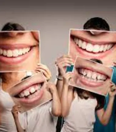 Imagem ilustrativa da imagem Transição da Odontologia Curativa Imediatista para a Preventiva e Conservadora