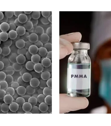 Imagem ilustrativa da imagem PMMA: conheça mais sobre o procedimento e seu uso na medicina