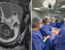 Bebê passa por cirurgia dentro da barriga da mãe