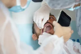 Imagem ilustrativa da imagem Saúde alerta sobre câncer de boca
