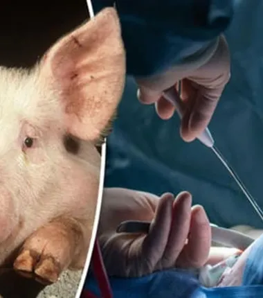 Imagem ilustrativa da imagem Paciente recebe coração artificil e rim de porco para viver