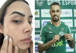 Imagem ilustrativa da imagem Ex-jogador do Goiás espanca e ameaça a ex-esposa de morte