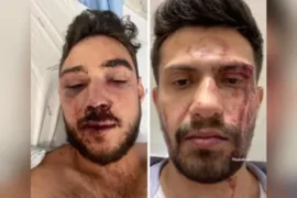 Imagem ilustrativa da imagem Casal gay brasileiro agredido em Lisboa pede justiça