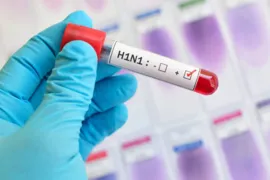 Imagem ilustrativa da imagem Casos de H1N1 crescem entre adultos; diagnósticos de covid-19 caem