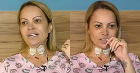Imagem ilustrativa da imagem Em tratamento, Solange Almeida revela sequelas após uso de vape: 'Irreconhecível'