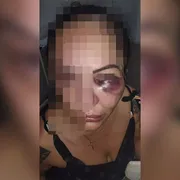 Imagem ilustrativa da imagem Mulher conta em vídeo como foi vítima de tentativa de feminicídio