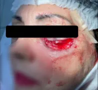 Imagem ilustrativa da imagem Odontóloga é presa após deformar pacientes