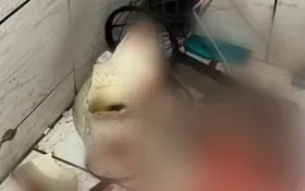 Imagem ilustrativa da imagem Mulher que se feriu após vaso sanitário quebrar continua na UTI, afirma hospital