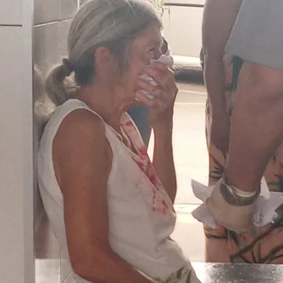 
		Idosa fratura o nariz após ser agredida por jovem no terminal do Vera Cruz