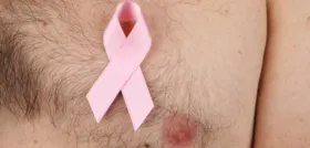 Imagem ilustrativa da imagem Câncer da mama também afeta os homens