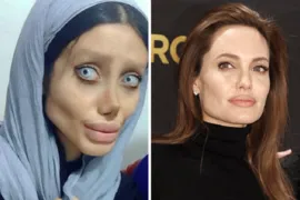 Imagem ilustrativa da imagem Iraniana faz 50 plásticas para ficar parecida com Angelina Jolie