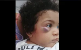 Imagem ilustrativa da imagem Criança fica ferida após queda de berço em hospital público