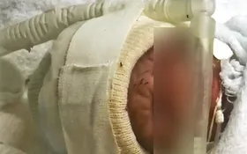 Imagem ilustrativa da imagem Incubadora de recém-nascido é invadida por formigas e servidores denunciam negligência