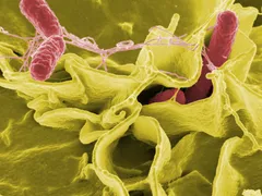 Imagem ilustrativa da imagem Estudo genético busca impedir infecção alimentar por salmonela