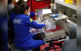 Imagem ilustrativa da imagem Gêmeas siamesas deixam o hospital, em Goiânia