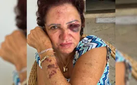 Imagem ilustrativa da imagem Suspeito de agredir e roubar ex-primeira-dama de Itaberaí é preso