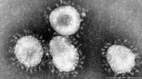 Imagem ilustrativa da imagem Caso de coronavírus é investigado em MG