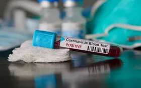 Imagem ilustrativa da imagem Mais um caso de coronavírus é confirmado em Anápolis