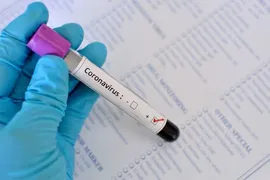 Imagem ilustrativa da imagem Anápolis é o segundo munícipio com maior número de casos de coronavírus em Goiás