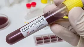 Imagem ilustrativa da imagem Vacina contra Covid-19 deve surgir em 2021, segundo pesquisador