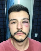 Imagem ilustrativa da imagem Matheus Ribeiro reage a assalto e deixa um alerta nas redes sociais.