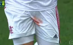 Imagem ilustrativa da imagem Jogador do Flamengo sofre trauma no testículo e deixa campo sangrando