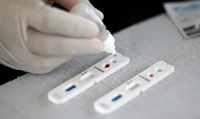 Imagem ilustrativa da imagem Roche faz parceria com Moderna para usar exames de covid-19 em testes de vacina