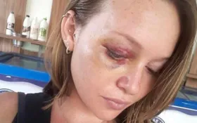 Imagem ilustrativa da imagem Lutador agride ex-mulher em distribuidora em Morrinhos
