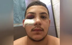 Imagem ilustrativa da imagem Jovem denuncia que foi agredido com socos por cantor sertanejo em Goiânia