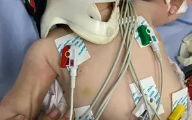 Imagem ilustrativa da imagem Pai de bebê internada com mais de 30 lesões no corpo é preso, em Anápolis