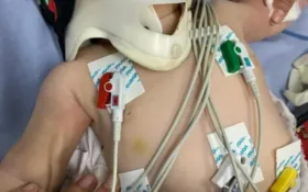 Imagem ilustrativa da imagem Bebê com mais de 30 lesões pelo corpo segue internada em estado grave