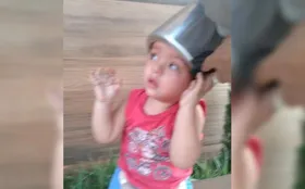 Imagem ilustrativa da imagem Menino de 2 anos fica com a cabeça presa em panela de pressão