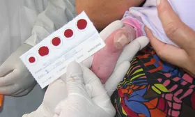 Imagem ilustrativa da imagem Estudo da UFMG já identificou 68 bebês nascidos com anticorpos para covid-19
