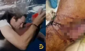 Imagem ilustrativa da imagem Ator de 'Jackass' é mordido por tubarão durante filmagens; assista
