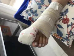 Imagem ilustrativa da imagem Cliente tem dedo amputado após ser ferida dentro de atacadista em Sorocaba