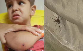 Imagem ilustrativa da imagem Menino é internado após ser picado por aranha