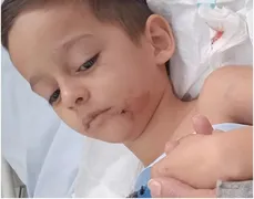 Imagem ilustrativa da imagem Criança atacada por rottweilers passa por cirurgia em hospital de Goiânia