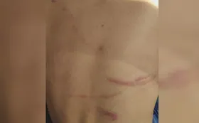 Imagem ilustrativa da imagem Homem é suspeito de agredir o filho com corda de varal em Goiás