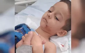 Imagem ilustrativa da imagem Criança que foi atacada por rottweilers na casa da babá precisa voltar a hospital minutos após receber alta