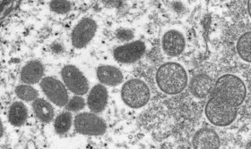 Imagem ilustrativa da imagem Brasil confirma primeira morte por varíola dos macacos