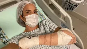 Imagem ilustrativa da imagem Após acidente com esqui, Ivete Sangalo passa por cirurgia no braço