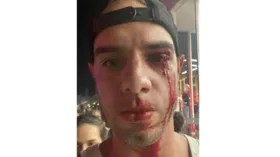 Imagem ilustrativa da imagem Rock in Rio: Fotógrafo é agredido após esbarrar em adolescente